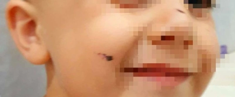 Мать малыша, над которым издевалась воспитатель на Сахалине, рассказала подробности