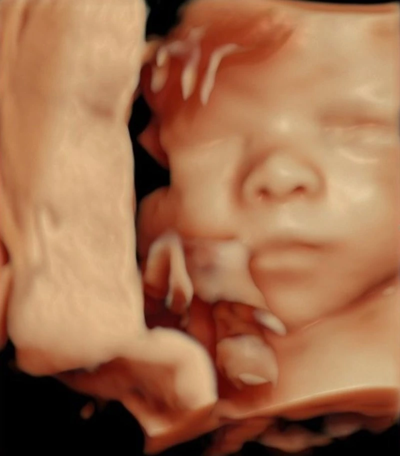 Родился четвертый ребенок, зачатый с помощью ЭКО на Сахалине