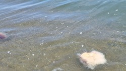«Как будто кипятком облили»: медуза ужалила отдыхающего в Охотске жителя Сахалина