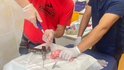 Врачи Сахалина научились устанавливать биодеградируемые импланты детям 