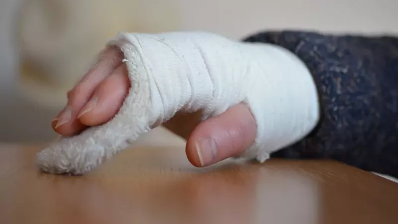 Прокуратура проверяет пришкольный лагерь в Корсакове, где первоклассник получил двойной перелом