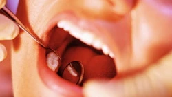 Зубной дефицит