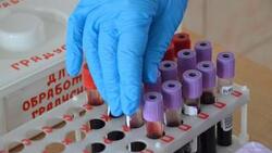 Сахалинцев приглашают бесплатно пройти тест на ВИЧ