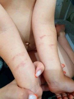 Бастрыкин взял на контроль случай с издевательством над ребенком в Южно-Сахалинске