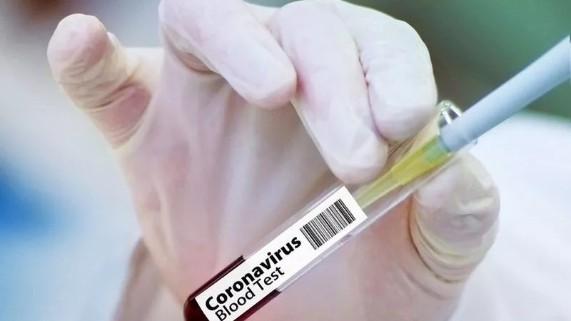 Еще трое больных коронавирусом умерли на Сахалине