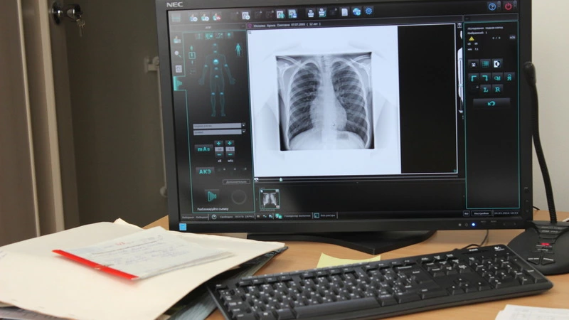 За минувшую неделю на Сахалине выявили 67 случаев внебольничной пневмонии