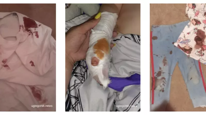 Поездка на море для двухлетней сахалинки закончилась пятью швами и наркозом